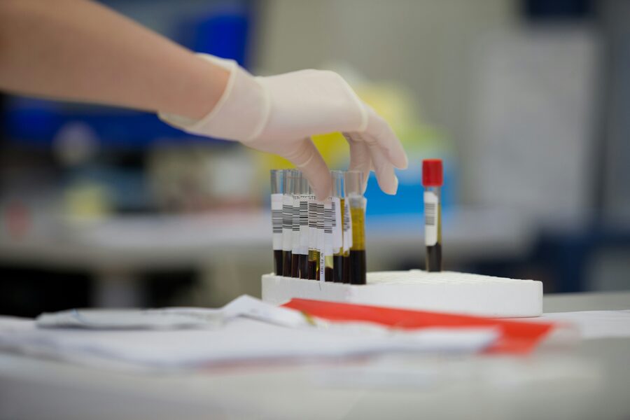 Laboratory blood sample analysis
